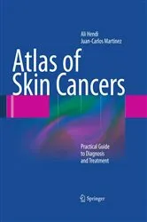 Book cover of Atlas of Skin Cancers by Ali Hendi