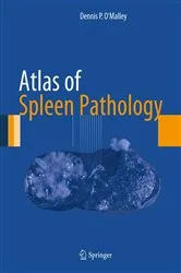 Book cover of Atlas of Spleen Pathology by Dennis P. O'Malley