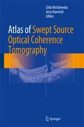 Book cover of Atlas of Swept Source Optical Coherence Tomography by Zofia Michalewska
