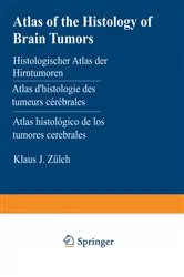 Book cover of Atlas of the Histology of Brain Tumors / Histologischer Atlas der Hirntumoren / Atlas d’histologie des tumeurs cérébrales / Atlas histológico de los tumores cerebrales / Гистологический атлас опухолей мозга человека by K.J. Zülch