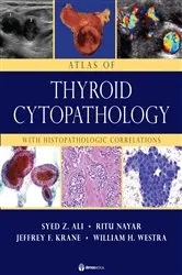 Book cover of Atlas of Thyroid Cytopathology by Syed Z. Ali