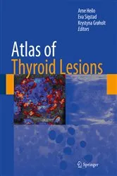 Book cover of Atlas of Thyroid Lesions by Arne Heilo
