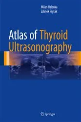 Book cover of Atlas of Thyroid Ultrasonography by Milan Halenka
