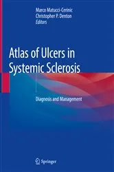 Book cover of Atlas of Ulcers in Systemic Sclerosis by Marco Matucci-Cerinic