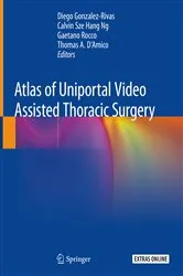 Book cover of Atlas of Uniportal Video Assisted Thoracic Surgery by Diego Gonzalez-Rivas