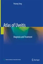 Book cover of Atlas of Uveitis by Peizeng Yang