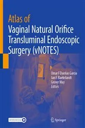 Book cover of Atlas of Vaginal Natural Orifice Transluminal Endoscopic Surgery (vNOTES) by Omar F Dueñas Garcia