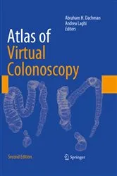 Book cover of Atlas of Virtual Colonoscopy (2nd ed.) by Abraham H. Dachman