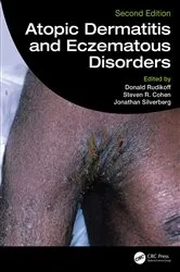 Book cover of Atopic Dermatitis and Eczematous Disorders (2nd ed.) by Donald Rudikoff