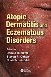Book cover of Atopic Dermatitis and Eczematous Disorders by Donald Rudikoff