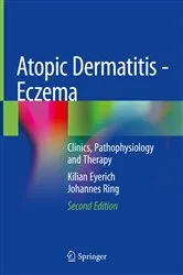 Book cover of Atopic Dermatitis - Eczema (2nd ed.) by Kilian Eyerich