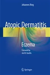 Book cover of Atopic Dermatitis by Johannes Ring