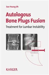 Book cover of Autologous Bone Plugs Fusion by S.-Y. Oh