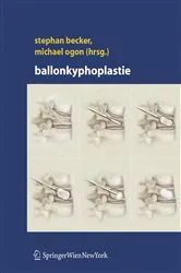 Book cover of Ballonkyphoplastie by Stephan Becker
