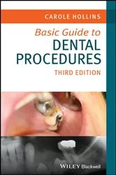 Book cover of Basic Guide to Dental Procedures (3rd ed.) by Carole Hollins