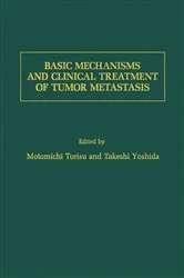 Book cover of Basic Mechanisms and Clinical Treatment of Tumor Metastasis by Motomichi Torisu