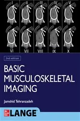 Book cover of Basic Musculoskeletal Imaging, Second Edition (2nd ed.) by Jamshid Tehranzadeh