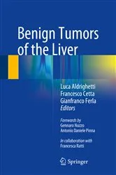 Book cover of Benign Tumors of the Liver by Luca Aldrighetti