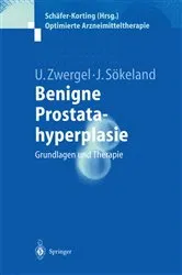 Book cover of Benigne Prostatahyperplasie by Ulrike Zwergel