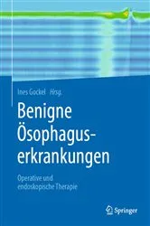 Book cover of Benigne Ösophaguserkrankungen by Ines Gockel