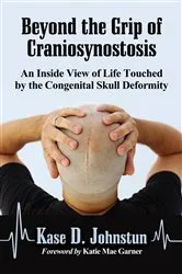 Book cover of Beyond the Grip of Craniosynostosis by Unknown
