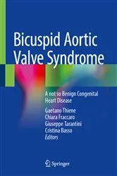 Book cover of Bicuspid Aortic Valve Syndrome by Unknown