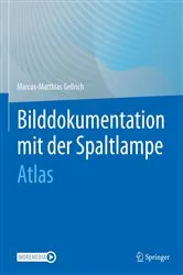 Book cover of Bilddokumentation mit der Spaltlampe by Marcus-Matthias Gellrich
