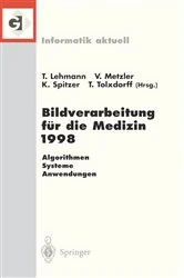 Book cover of Bildverarbeitung für die Medizin 1998 by Thomas Lehmann