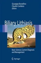 Book cover of Biliary Lithiasis by Giuseppe Borzellino