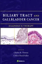 Book cover of Biliary Tract and Gallbladder Cancer by Clifton D. Fuller
