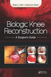 Book cover of Biologic Knee Reconstruction by Brian Cole