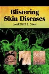 Book cover of Blistering Skin Diseases by Lawrence Chan