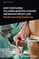 Book cover of Body Contouring Following Bariatric Surgery and Massive Weight Loss by Bishara Atiyeh