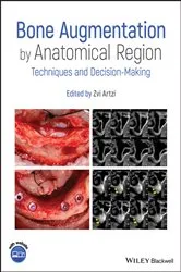 Book cover of Bone Augmentation by Anatomical Region by Zvi Artzi