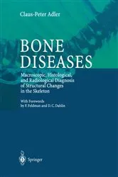 Book cover of Bone Diseases by Claus-Peter Adler