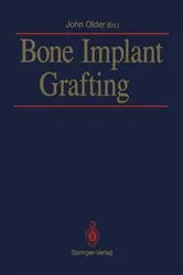 Book cover of Bone Implant Grafting by John Older