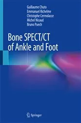 Book cover of Bone SPECT/CT of Ankle and Foot by Guillaume Chuto