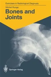 Book cover of Bones and Joints by Michel Runge