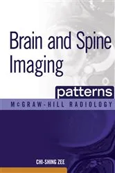 Book cover of Brain and Spine Imaging Patterns by Unknown