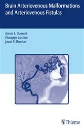 Book cover of Brain Arteriovenous Malformations and Arteriovenous Fistulas by Aaron S. Dumont