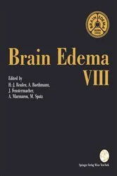 Book cover of Brain Edema VIII by Hans-J. Reulen