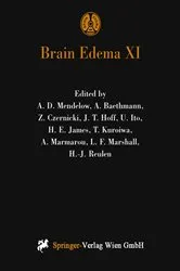 Book cover of Brain Edema XI by A.D. Mendelow