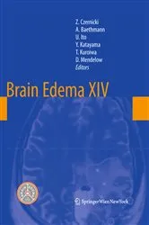 Book cover of Brain Edema XIV by Zbigniew Czernicki