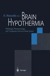 Book cover of Brain Hypothermia by N. Hayashi