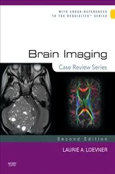 Book cover of Brain Imaging: Case Review Series E-Book (2nd ed.) by Laurie A. Loevner MD