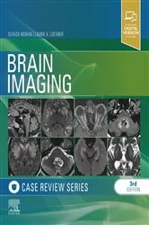 Book cover of Brain Imaging: Case Review Series E-Book (3rd ed.) by Suyash Mohan MD