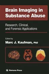 Book cover of Brain Imaging in Substance Abuse by Marc J. Kaufman