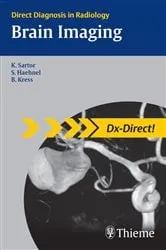 Book cover of Brain Imaging by Klaus Sartor
