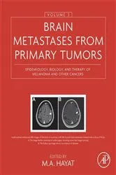 Book cover of Brain Metastases from Primary Tumors, Volume 3 by M. A. Hayat