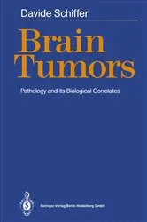 Book cover of Brain Tumors by M.T. Giordana